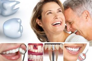 Cấy ghép Implant - Nha Khoa Trường Sơn