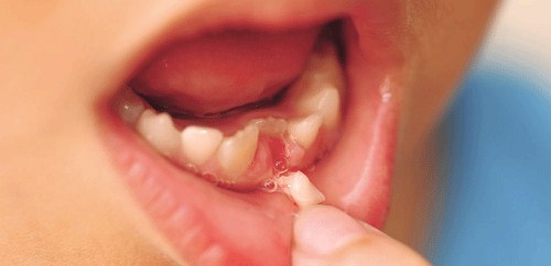 Làm Sao Phân Biệt Được Răng Sữa Và Răng Vĩnh Viễn -3